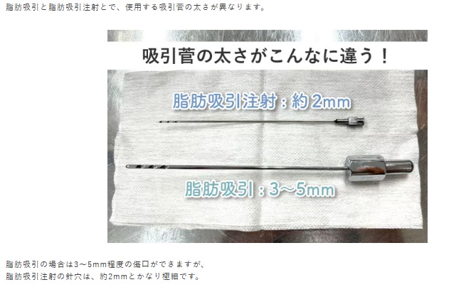 湘南脂肪吸引注射