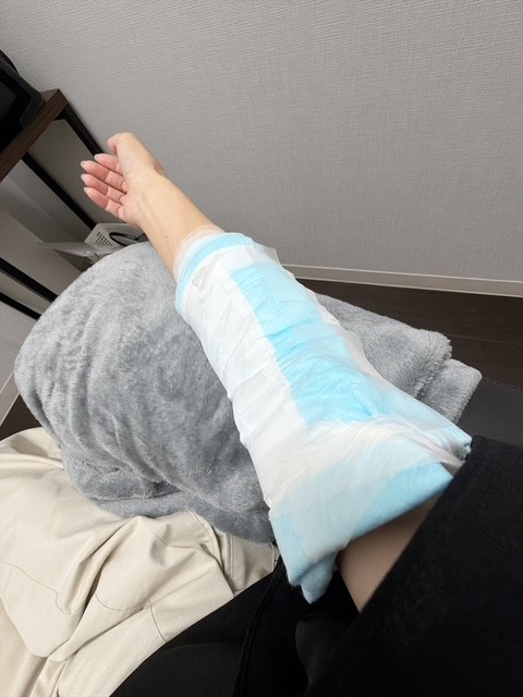 二の腕脂肪吸引注射手術レポ